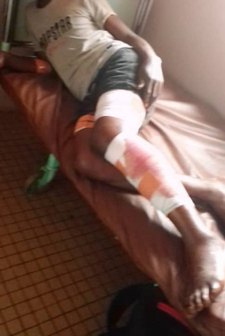 Kyé-Ossi Border Dispute: Wounded Cameroonian citizen under treatment at Yaoundé Military Hospital